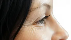 Varför uppstår rynkor kring ögonen? Fem faktorer som få tänker på