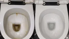 Inga spår av irriterande gula fläckar kvar: kom ihåg dessa 3 sätt att rengöra toaletten